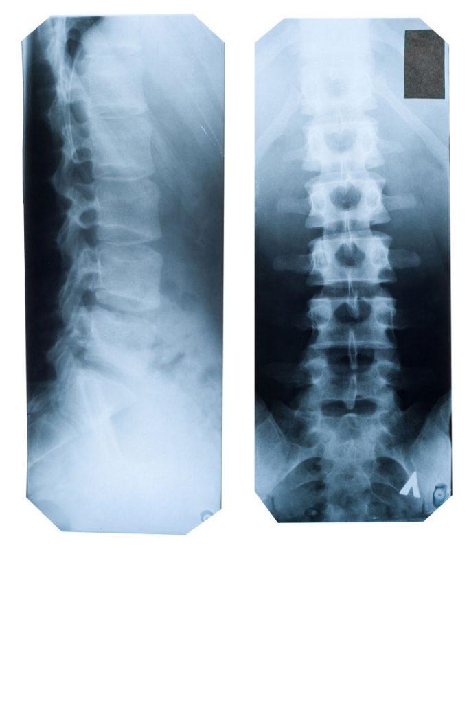 Wenn man plötzlich merkt, dass der eigene Körper Grenzen setzt